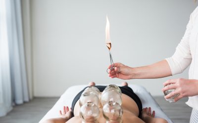 Cupping Therapy: Does it Work?